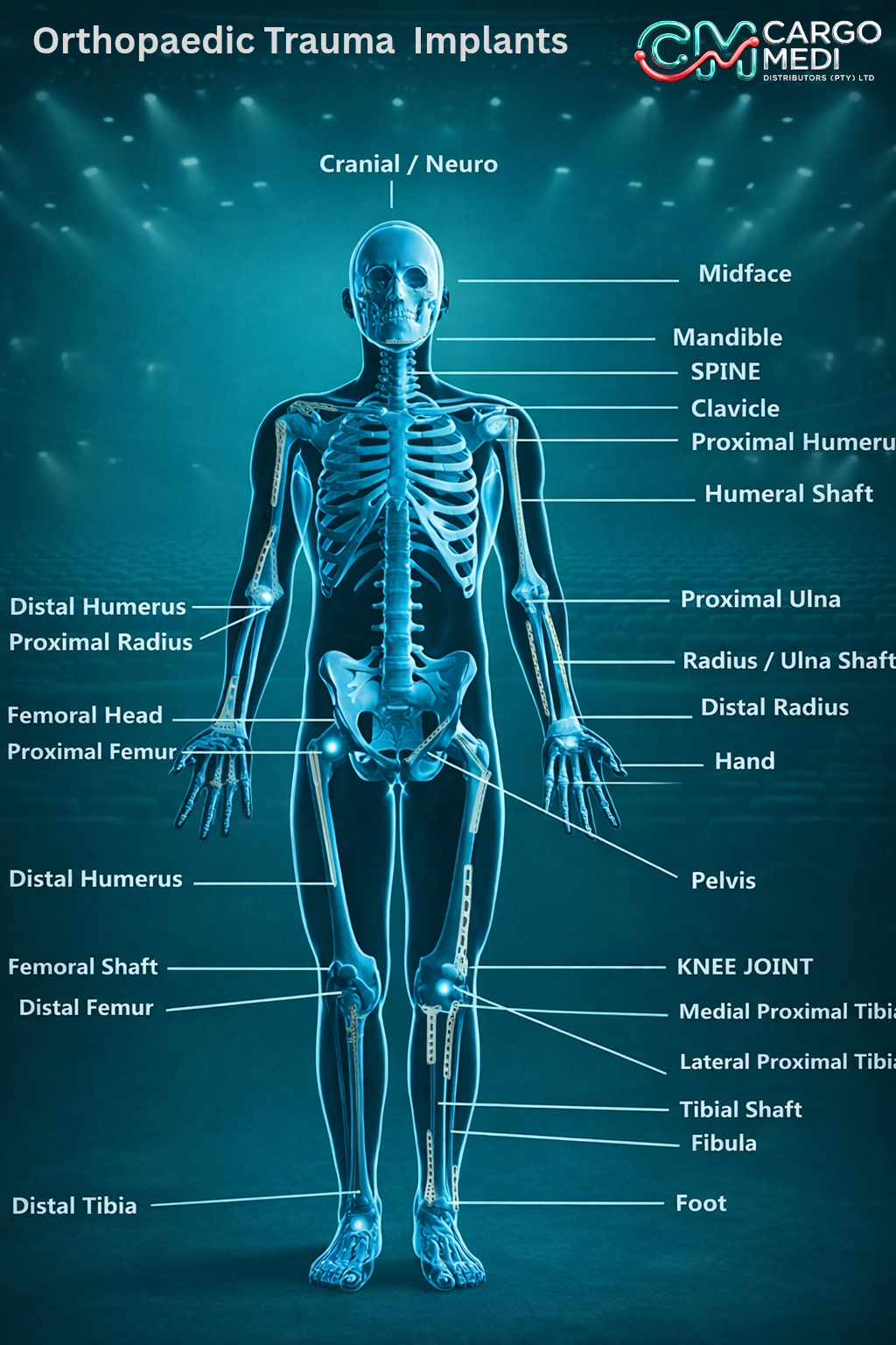 Understanding Orthopedic Trauma and the Role of Implants in Recovery